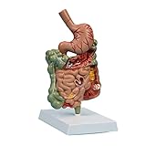 Generisch Organe Modell Menschliches Modell Pathologisches Verdauungssystem Modell Menschlicher Magen Anatomie Modell Magen Dickdarm Medizin Lehrmodell
