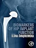 Biomarkers of Hip Implant Function (English Edition)
