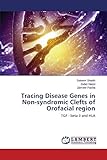 Tracing Disease Genes in Non-syndromic Clefts of Orofacial region: TGF - beta 3 and HLA